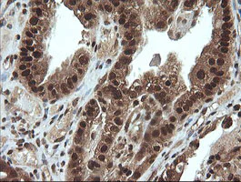 Immunohistochemistry (Formalin/PFA-fixed paraffin-embedded sections) - Anti-Von Hippel Lindau/VHL antibody [OTI1E1] - BSA and Azide free (AB273655)