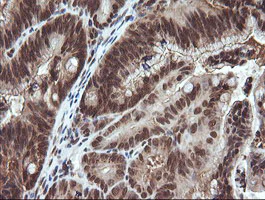 Immunohistochemistry (Formalin/PFA-fixed paraffin-embedded sections) - Anti-Von Hippel Lindau/VHL antibody [OTI1E1] - BSA and Azide free (AB273655)