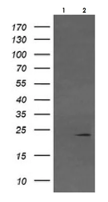 Western blot - Anti-Von Hippel Lindau/VHL antibody [OTI1E1] - BSA and Azide free (AB273655)