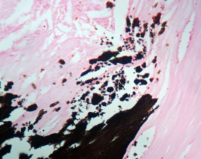 Immunohistochemistry (Formalin/PFA-fixed paraffin-embedded sections) - Von Kossa Stain Kit (Calcium Stain) (AB150687)