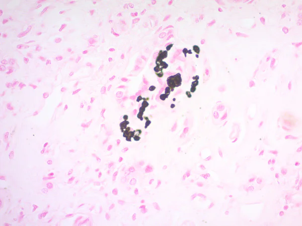Immunohistochemistry (Formalin/PFA-fixed paraffin-embedded sections) - Von Kossa Stain Kit (Calcium Stain) (AB150687)