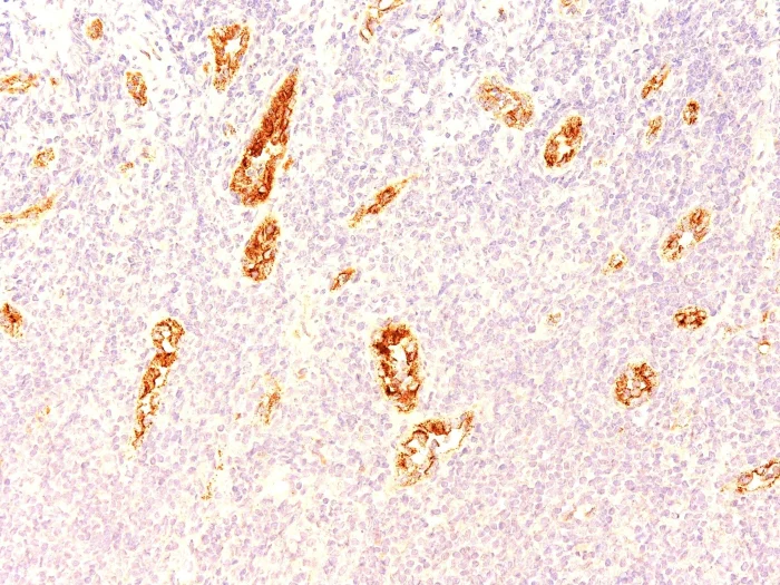 Immunohistochemistry (Formalin/PFA-fixed paraffin-embedded sections) - Anti-Von Willebrand Factor antibody [3E2D10] (AB194405)