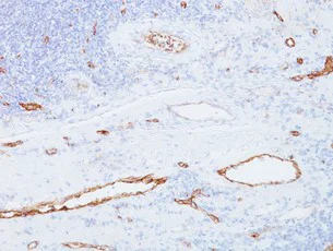 Immunohistochemistry (Formalin/PFA-fixed paraffin-embedded sections) - Anti-Von Willebrand Factor antibody [3E2D10] (AB194405)