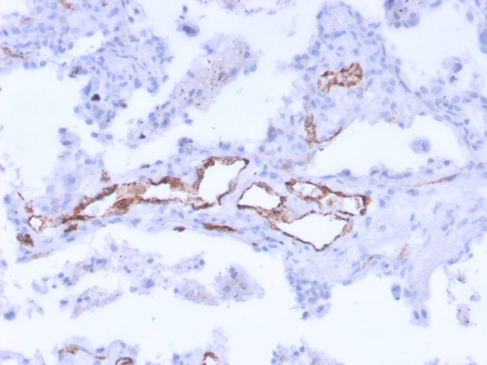 Immunohistochemistry (Formalin/PFA-fixed paraffin-embedded sections) - Anti-Von Willebrand Factor antibody [3E2D10 + VWF635] (AB201336)