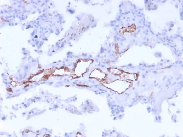 Immunohistochemistry (Formalin/PFA-fixed paraffin-embedded sections) - Anti-Von Willebrand Factor antibody [3E2D10 + VWF635] (AB201336)