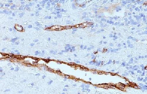 Immunohistochemistry (Formalin/PFA-fixed paraffin-embedded sections) - Anti-Von Willebrand Factor antibody [3E2D10 + VWF635] - BSA and Azide free (AB212949)