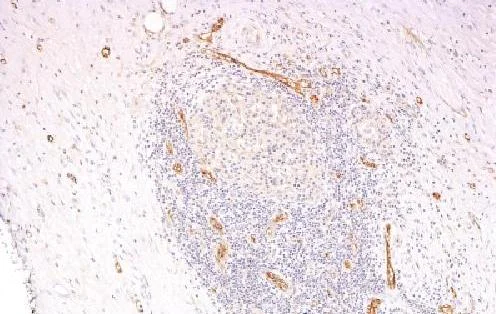 Immunohistochemistry (Formalin/PFA-fixed paraffin-embedded sections) - Anti-Von Willebrand Factor antibody [3E2D10 + VWF635] - BSA and Azide free (AB212949)