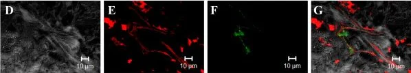 Immunohistochemistry - Anti-Von Willebrand Factor antibody (AB6994)