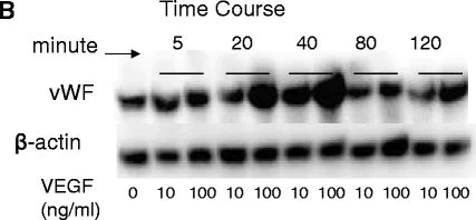 Western blot - Anti-Von Willebrand Factor antibody (AB6994)