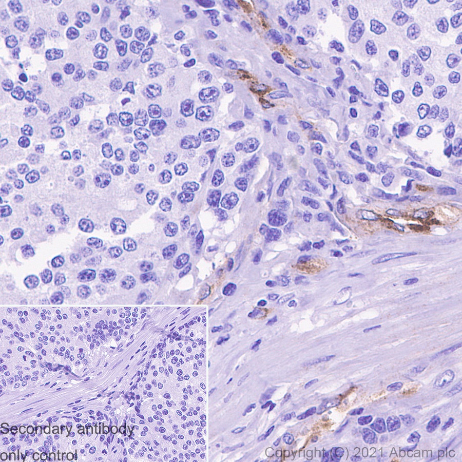 Immunohistochemistry (Formalin/PFA-fixed paraffin-embedded sections) - Anti-Von Willebrand Factor antibody [EPR12010] (AB179451)