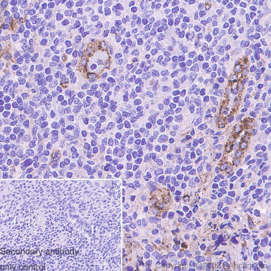 Immunohistochemistry (Formalin/PFA-fixed paraffin-embedded sections) - Anti-Von Willebrand Factor antibody [EPR12010] (AB179451)