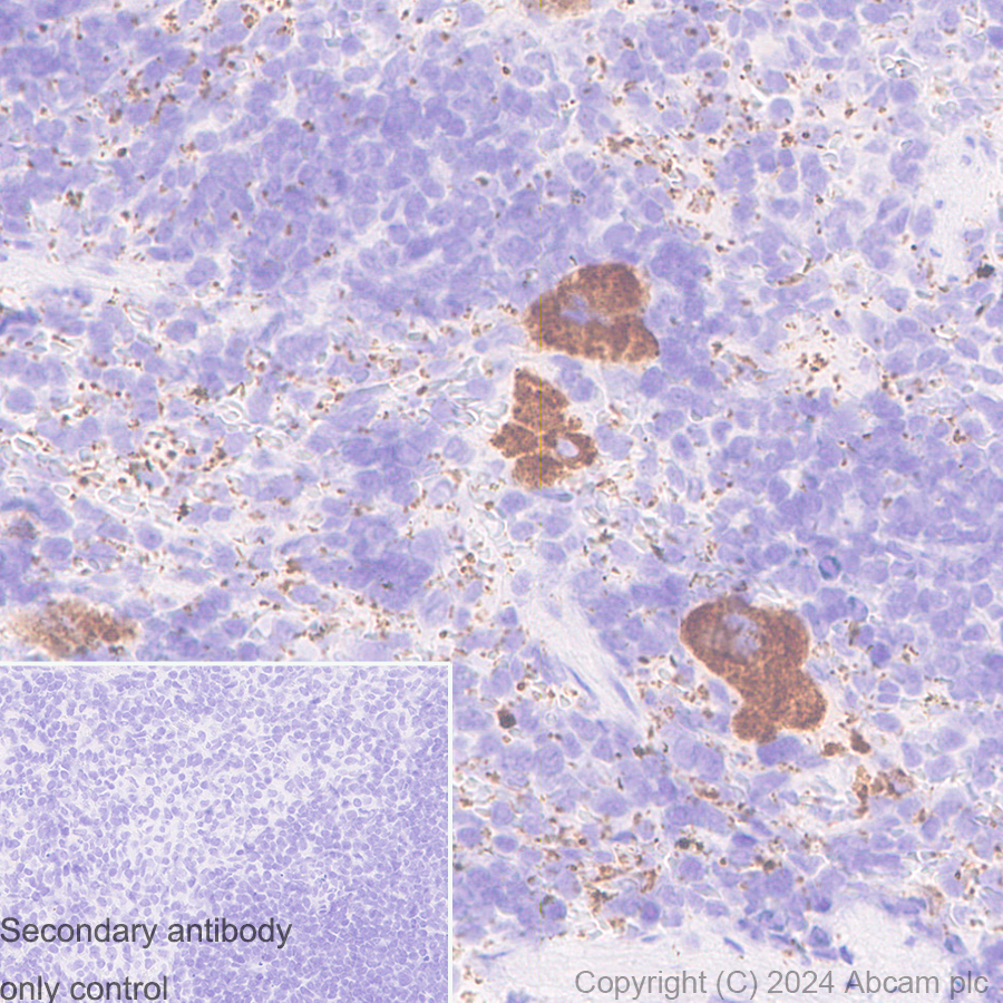 Immunohistochemistry (Formalin/PFA-fixed paraffin-embedded sections) - Anti-Von Willebrand Factor antibody [EPR12011] - BSA and Azide free (AB240177), expandable thumbnail