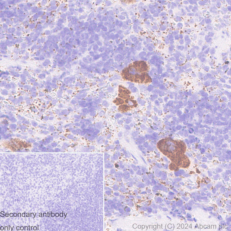 Immunohistochemistry (Formalin/PFA-fixed paraffin-embedded sections) - Anti-Von Willebrand Factor antibody [EPR12011] - BSA and Azide free (AB240177)