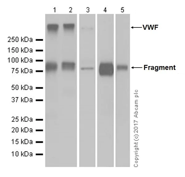 Western blot - Anti-Von Willebrand Factor antibody [EPR18569-105] - BSA and Azide free (AB228523)