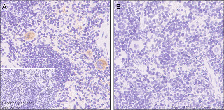 Immunohistochemistry (Formalin/PFA-fixed paraffin-embedded sections) - Anti-Von Willebrand Factor antibody [EPR25069-131] - BSA and Azide free (AB287967)