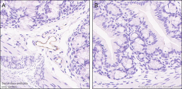 Immunohistochemistry (Formalin/PFA-fixed paraffin-embedded sections) - Anti-Von Willebrand Factor antibody [EPR25069-131] - BSA and Azide free (AB287967)