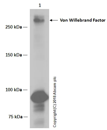 Western blot - Anti-Von Willebrand Factor antibody [EPSISR15] (AB154193)