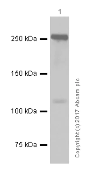 Western blot - Anti-Von Willebrand Factor antibody [EPSISR15] (AB154193)