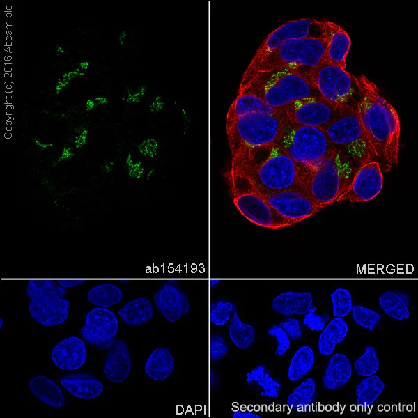Immunocytochemistry/ Immunofluorescence - Anti-Von Willebrand Factor antibody [EPSISR15] - BSA and Azide free (AB232473)