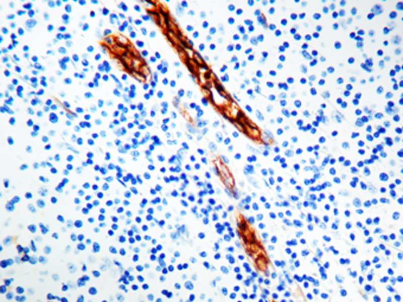 Immunohistochemistry (Formalin/PFA-fixed paraffin-embedded sections) - Anti-Von Willebrand Factor antibody [F8/86] (AB778), expandable thumbnail