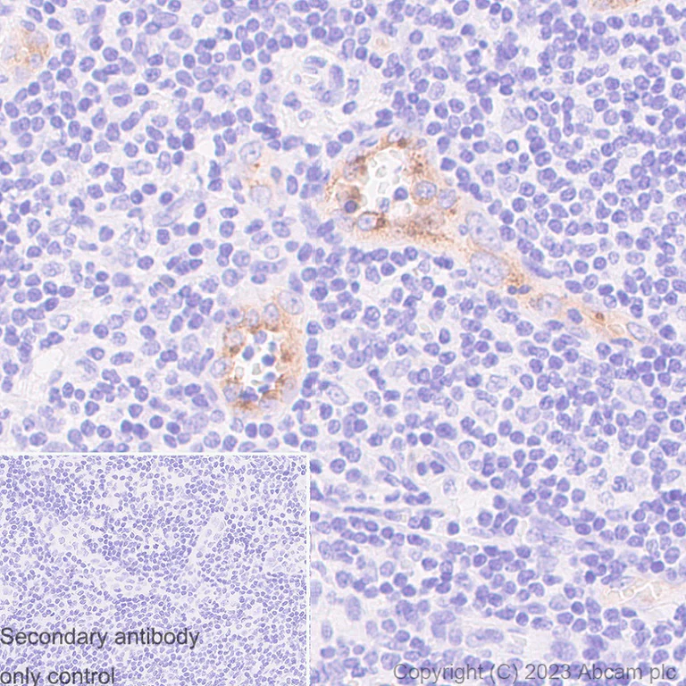 Immunohistochemistry (Formalin/PFA-fixed paraffin-embedded sections) - Anti-Von Willebrand Factor antibody [RM1068] (AB316979)
