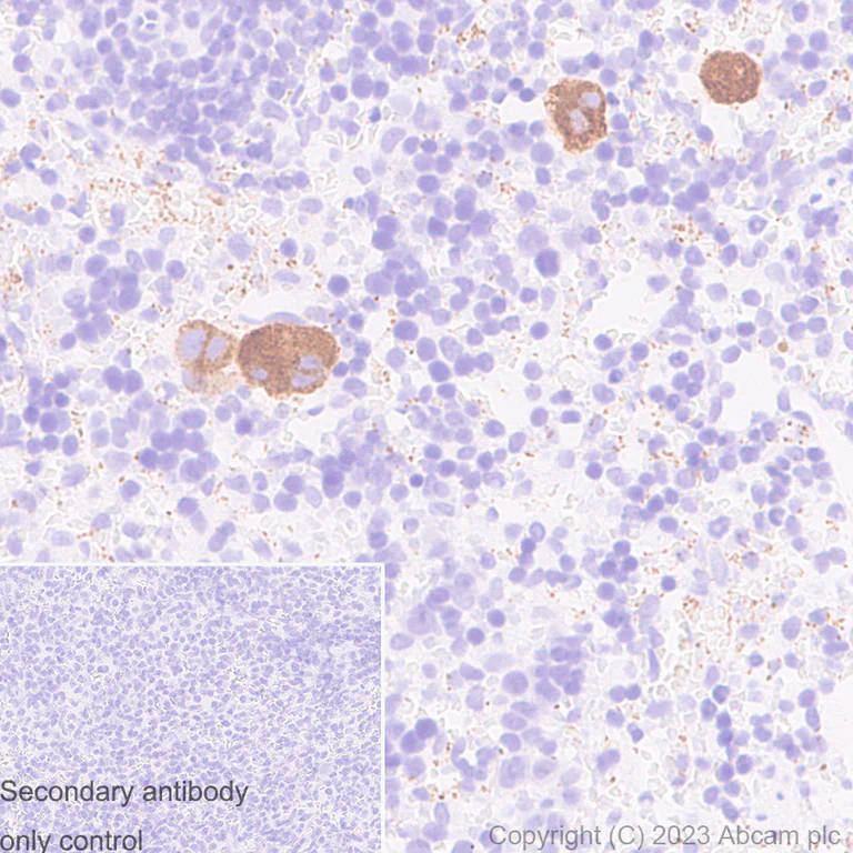 Immunohistochemistry (Formalin/PFA-fixed paraffin-embedded sections) - Anti-Von Willebrand Factor antibody [RM1068] (AB316979)