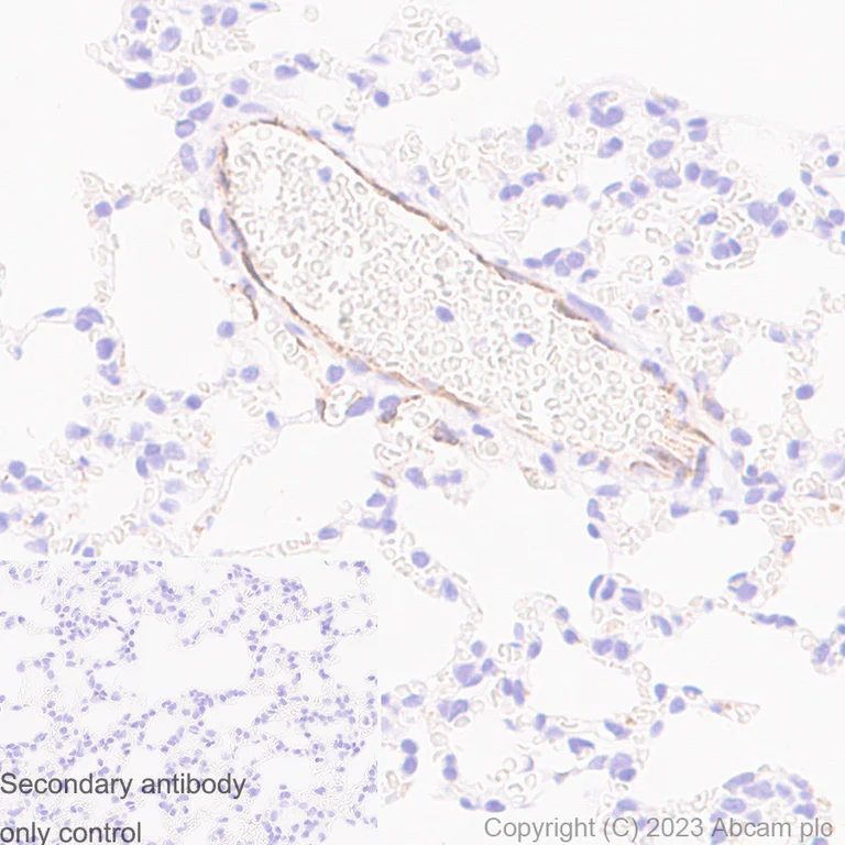 Immunohistochemistry (Formalin/PFA-fixed paraffin-embedded sections) - Anti-Von Willebrand Factor antibody [RM1068] (AB316979)