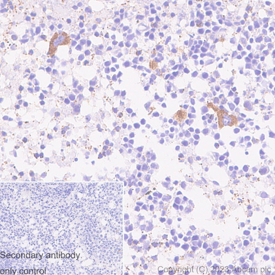 Immunohistochemistry (Formalin/PFA-fixed paraffin-embedded sections) - Anti-Von Willebrand Factor antibody [RM1068] - BSA and Azide free (ab316980), expandable thumbnail