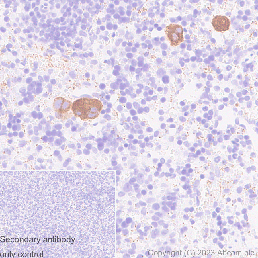 Immunohistochemistry (Formalin/PFA-fixed paraffin-embedded sections) - Anti-Von Willebrand Factor antibody [RM1068] - BSA and Azide free (ab316980), expandable thumbnail