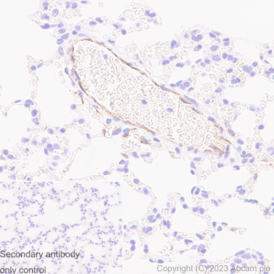 Immunohistochemistry (Formalin/PFA-fixed paraffin-embedded sections) - Anti-Von Willebrand Factor antibody [RM1068] - BSA and Azide free (ab316980), expandable thumbnail
