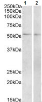 Western blot - Anti-VPAC1 antibody (AB123517), expandable thumbnail