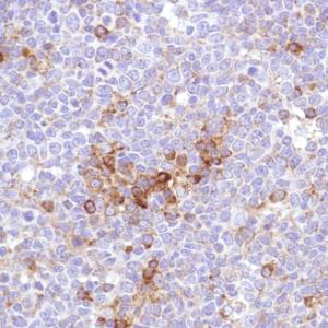 Immunohistochemistry (Formalin/PFA-fixed paraffin-embedded sections) - Anti-VPAC1 antibody [SP234] (AB183312)