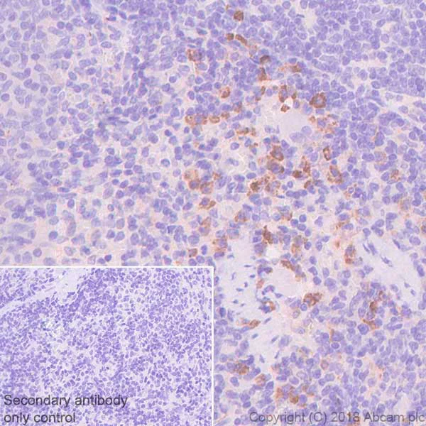 Immunohistochemistry (Formalin/PFA-fixed paraffin-embedded sections) - Anti-VPAC1 antibody [SP234] - BSA and Azide free (AB245743)