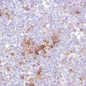 Immunohistochemistry (Formalin/PFA-fixed paraffin-embedded sections) - Anti-VPAC1 antibody [SP234] - BSA and Azide free (AB245743)
