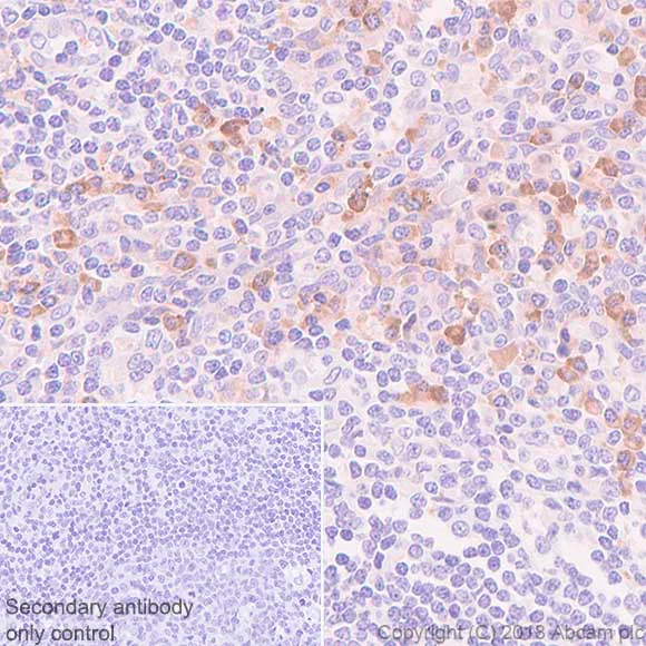 Immunohistochemistry (Formalin/PFA-fixed paraffin-embedded sections) - Anti-VPAC1 antibody [SP234] - BSA and Azide free (AB245743)