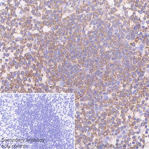 Immunohistochemistry (Formalin/PFA-fixed paraffin-embedded sections) - Anti-VPAC2 antibody [SP235] (AB183334)