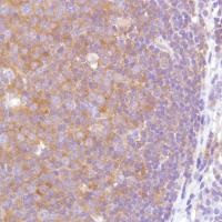 Immunohistochemistry (Formalin/PFA-fixed paraffin-embedded sections) - Anti-VPAC2 antibody [SP235] (AB183334)