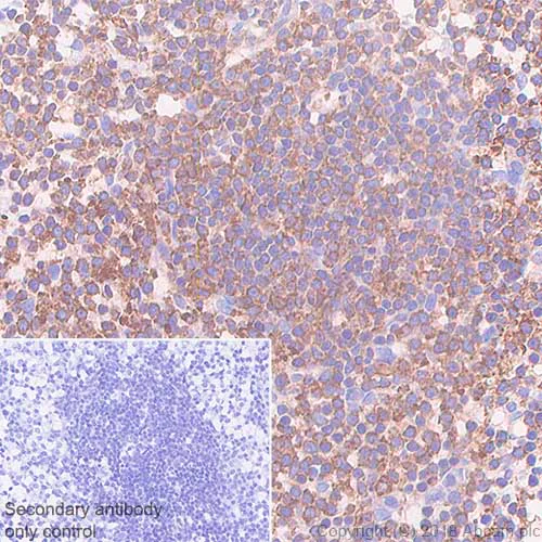 Immunohistochemistry (Formalin/PFA-fixed paraffin-embedded sections) - Anti-VPAC2 antibody [SP235] - BSA and Azide free (AB246352)