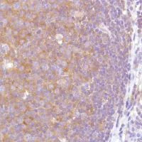 Immunohistochemistry (Formalin/PFA-fixed paraffin-embedded sections) - Anti-VPAC2 antibody [SP235] - BSA and Azide free (AB246352)