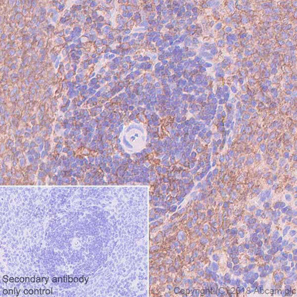 Immunohistochemistry (Formalin/PFA-fixed paraffin-embedded sections) - Anti-VPAC2 antibody [SP235] - BSA and Azide free (AB246352)