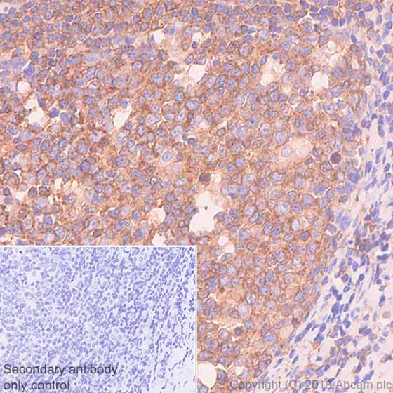 Immunohistochemistry (Formalin/PFA-fixed paraffin-embedded sections) - Anti-VPAC2 antibody [SP235] - BSA and Azide free (AB246352)