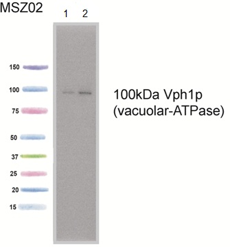 Western blot - Anti-VPH1 antibody [10D7A7B2] (AB113683)