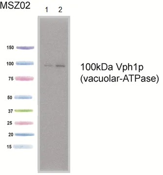 Western blot - Anti-VPH1 antibody [10D7A7B2] (AB113683)