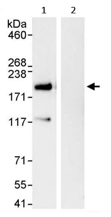 Immunoprecipitation - Anti-VPRBP antibody (AB245483)