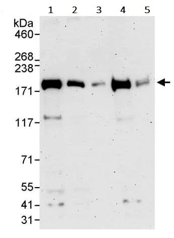 Western blot - Anti-VPRBP antibody (AB245483)