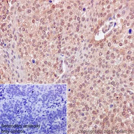 Immunohistochemistry (Formalin/PFA-fixed paraffin-embedded sections) - Anti-VPRBP antibody [EPR16012] (AB202587)