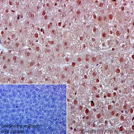 Immunohistochemistry (Formalin/PFA-fixed paraffin-embedded sections) - Anti-VPRBP antibody [EPR16012] (AB202587)