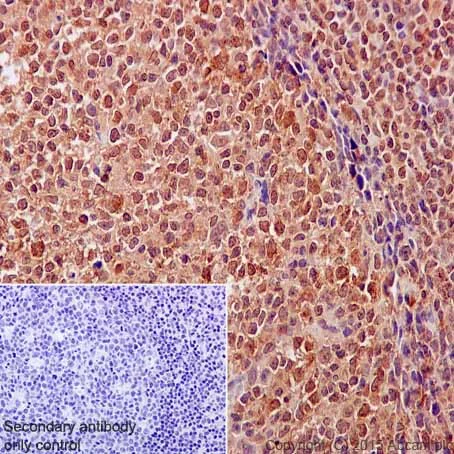 Immunohistochemistry (Formalin/PFA-fixed paraffin-embedded sections) - Anti-VPRBP antibody [EPR16012] (AB202587)