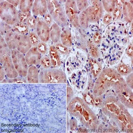 Immunohistochemistry (Formalin/PFA-fixed paraffin-embedded sections) - Anti-VPRBP antibody [EPR16012] - BSA and Azide free (AB251381)
