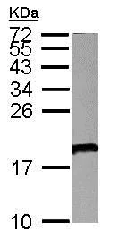 Western blot - Anti-VPREB1 antibody (AB155263)